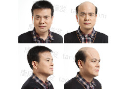 男士假发排名 最经典的5款假发造型，哪一款更适合你？