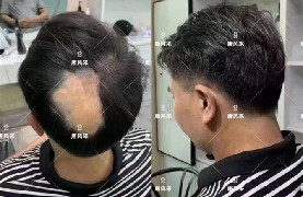重庆定做假发一般多少钱，越便宜越好？错了!