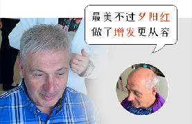 南京假发中老年：头顶稀疏老外变形记，归来仍是少年！
